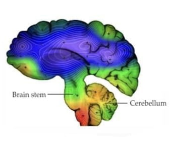 brain-stem